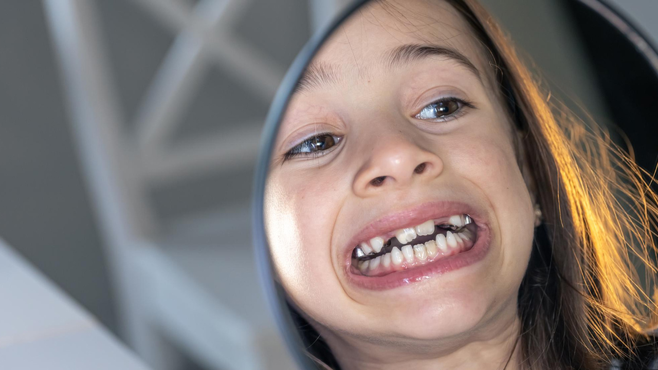Anchorage in Orthodontics