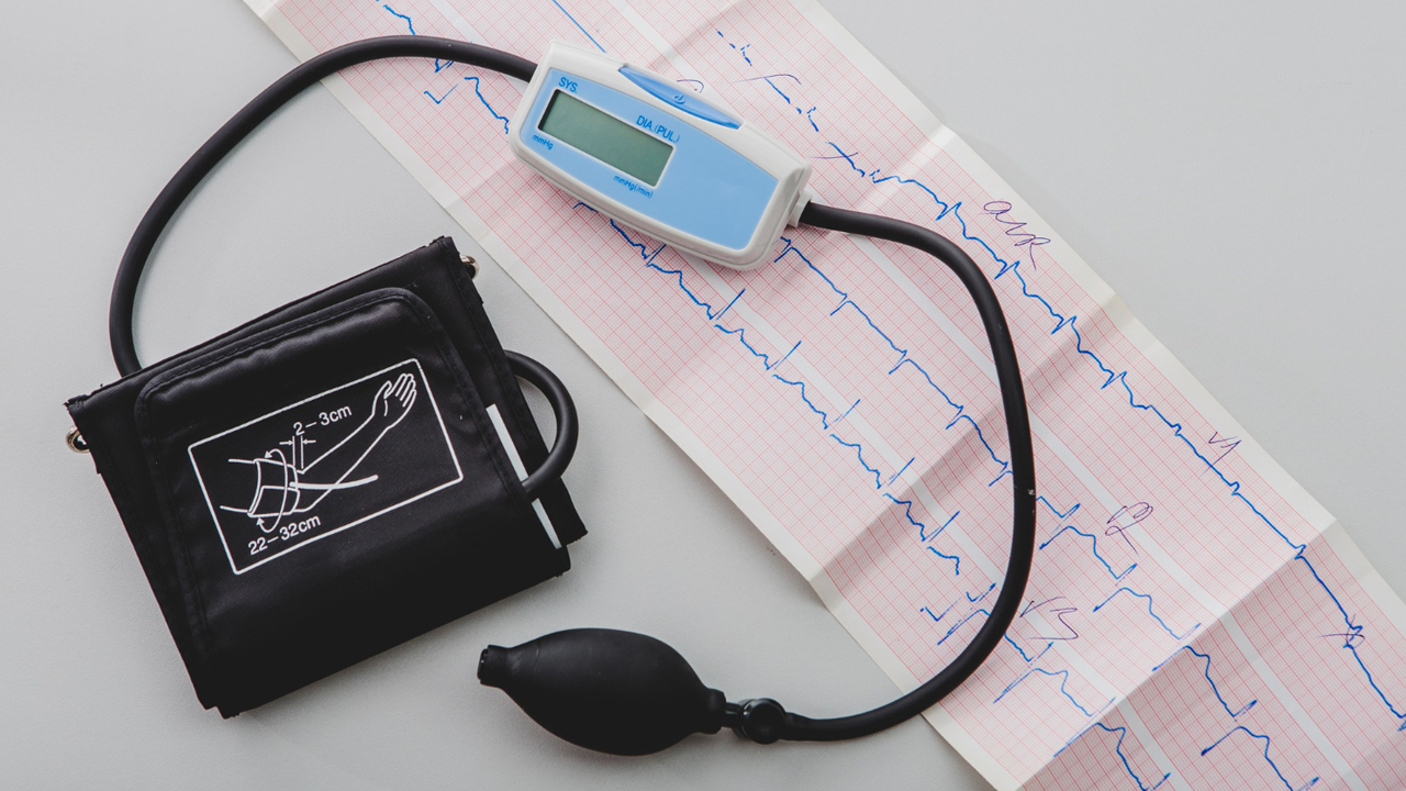 ECG Secrets of Myocardial Infarction