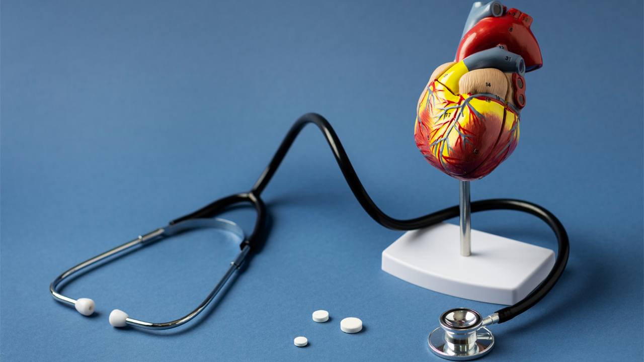 Prevention of Myocardial Infarction: A Comprehensive Guide for Healthcare Professionals
