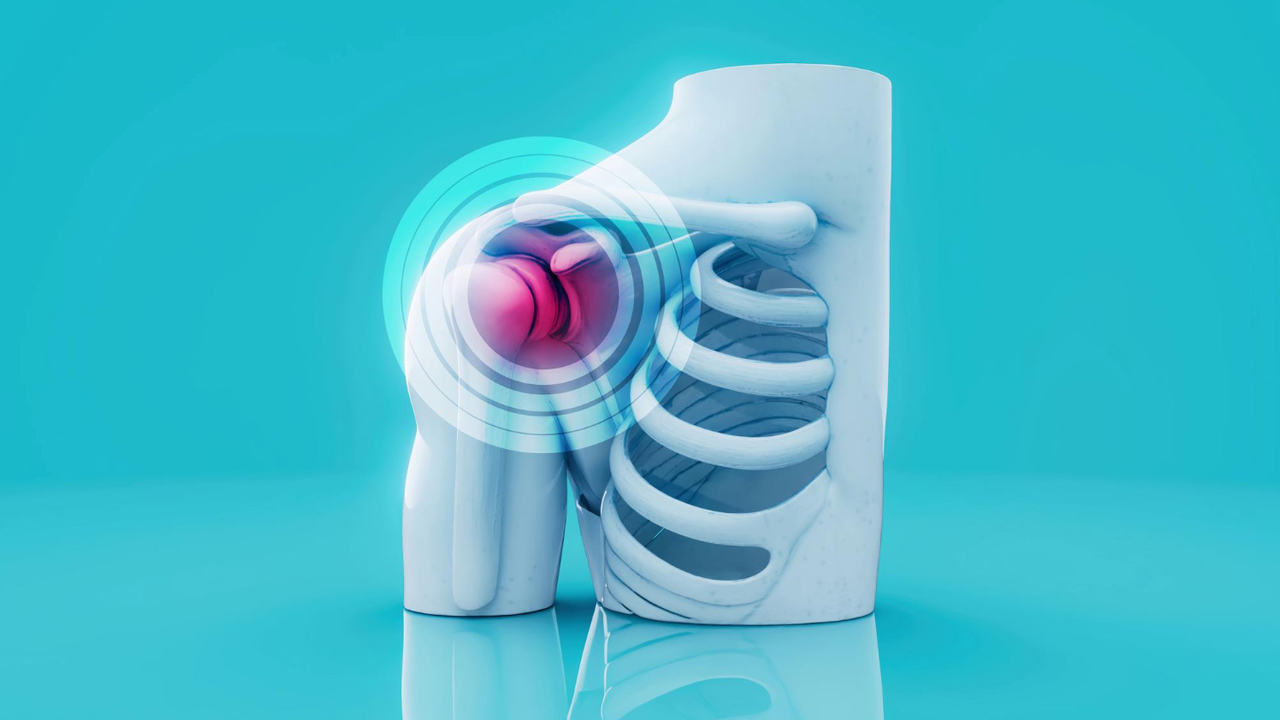 Shoulder Joint Complex: Assessment and Physical Therapy Management